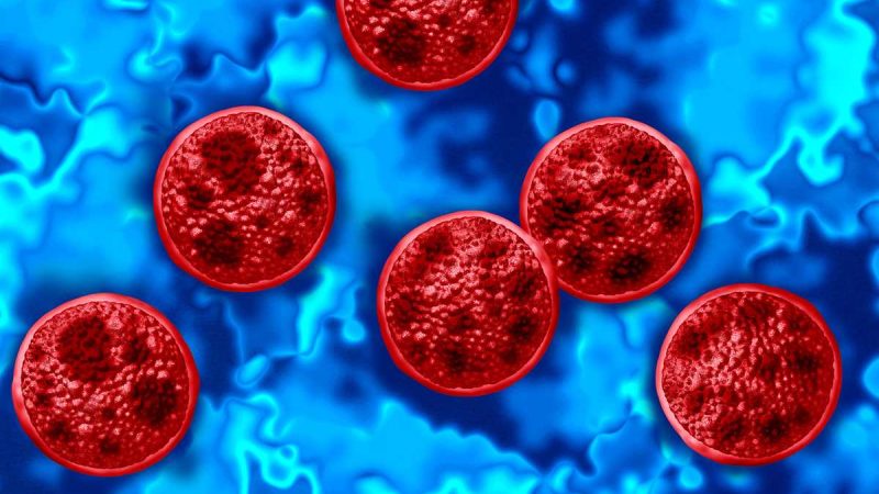 Cyclospora Outbreak Surges in Hamilton County and Across Ohio