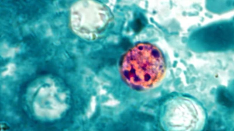 A Rapidly Expanding National Outbreak