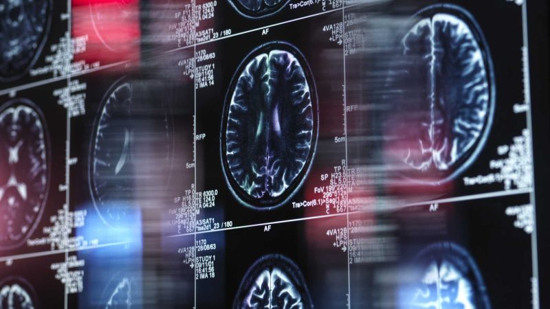 Predicting Cognitive Risk: The 10-Year Outlook