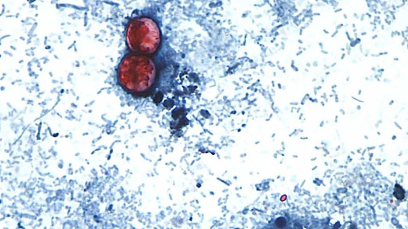 Understanding the Parasitic Illness