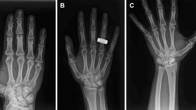 Overcoming Decades of Imaging Limitations