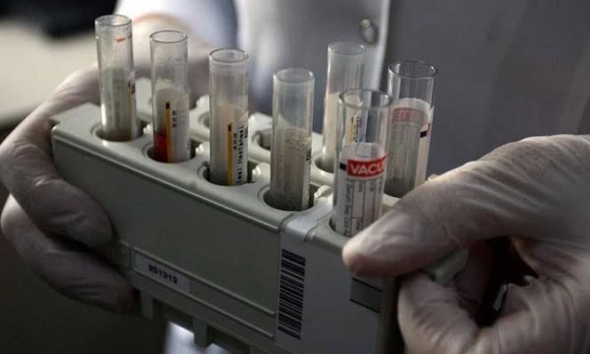 A Non-Invasive Shift in Liver Diagnostics
