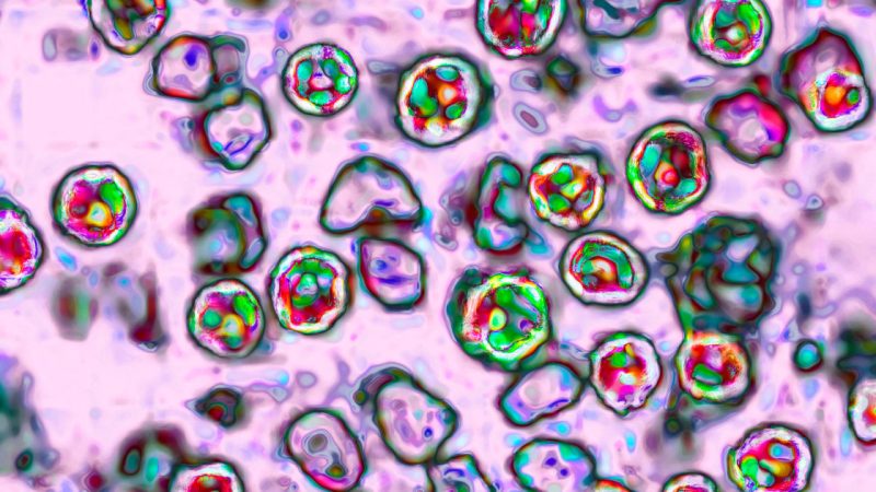 US Measles Cases Top 4,000, Far Surpassing Last Year, CDC Says