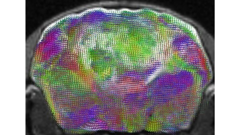 Stanford Medicine Transplants Human Brain Organoids Into Bioengineered Mice