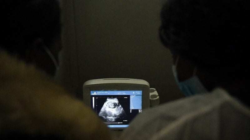 Egyptian Doctors Find Rare Fetus in Toddler's Stomach